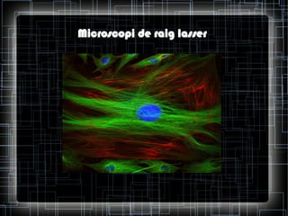 Microscopi de raig lasser

 
