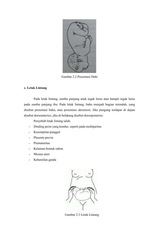 Gambar 2.2 Presentasi Dahi


c. Letak Lintang


       Pada letak lintang, sumbu panjang anak tegak lurus atau hampir tegak lurus
pada sumbu panjang ibu. Pada letak lintang, bahu menjadi bagian terendah, yang
disebut presentasi bahu, atau presentasi akromion. Jika pungung terdapat di depan
disebut dorsoanterior, jika di belakang disebut dorsoposterior.
       Penyebab letak lintang ialah:
   -   Dinding perut yang kendur, seperti pada multiparitas
   -   Kesempitan panggul
   -   Plasenta previa
   -   Prematuritas
   -   Kelainan bentuk rahim
   -   Mioma uteri
   -   Kehamilan ganda




                                Gambar 2.3 Letak Lintang
 