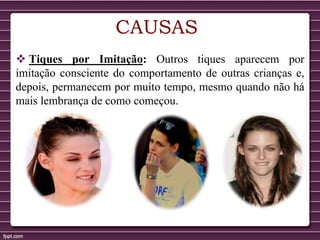 CAUSAS
 Tiques por Imitação: Outros tiques aparecem por
imitação consciente do comportamento de outras crianças e,
depois, permanecem por muito tempo, mesmo quando não há
mais lembrança de como começou.
 