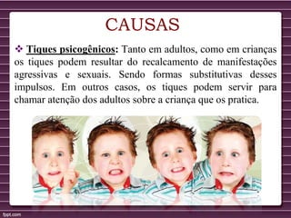 CAUSAS
 Tiques psicogênicos: Tanto em adultos, como em crianças
os tiques podem resultar do recalcamento de manifestações
agressivas e sexuais. Sendo formas substitutivas desses
impulsos. Em outros casos, os tiques podem servir para
chamar atenção dos adultos sobre a criança que os pratica.
 