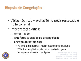 Avaliação individualizadaGill IS et al. J Urol (2002)Weld KJ et al. Urology (2006)