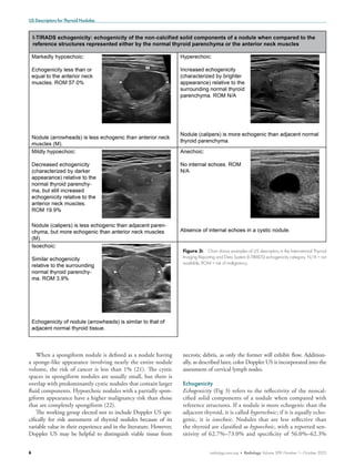 International Consensus on Ultrasound Lexicon for Thyroid Nodules to ...