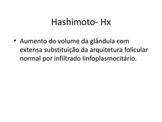 Hashimoto- Hx Aumento do volume da glândula com extensa substituição da arquitetura folicular normal por infiltrado linfoplasmocitário. 