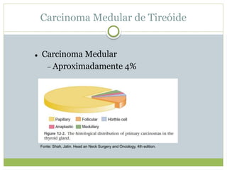 Carcinoma Medular de Tireóide
 Carcinoma Medular
 Aproximadamente 4%
Fonte: Shah, Jatin. Head an Neck Surgery and Oncology, 4th edition.
 