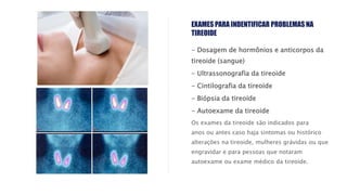 - Dosagem de hormônios e anticorpos da
tireoide (sangue)
- Ultrassonografia da tireoide
- Cintilografia da tireoide
- Biópsia da tireoide
- Autoexame da tireoide
Os exames da tireoide são indicados para
anos ou antes caso haja sintomas ou histórico
alterações na tireoide, mulheres grávidas ou que
engravidar e para pessoas que notaram
autoexame ou exame médico da tireoide.
EXAMES PARA INDENTIFICAR PROBLEMAS NA
TIREOIDE
 
