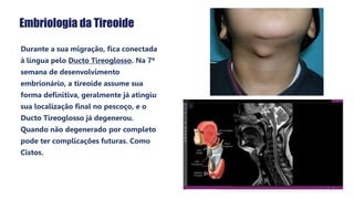 Embriologia da Tireoide
• Durante a sua migração, fica conectada
à língua pelo Ducto Tireoglosso. Na 7ª
semana de desenvolvimento
embrionário, a tireoide assume sua
forma definitiva, geralmente já atingiu
sua localização final no pescoço, e o
Ducto Tireoglosso já degenerou.
Quando não degenerado por completo
pode ter complicações futuras. Como
Cistos.
 