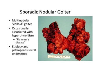 Sporadic Nodular Goiter
• Multinodular
  “colloid” goiter
• Occasionally
  associated with
  hyperthyroidism
   – “Plummer’s
     disease”
• Etiology and
  pathogenesis NOT
  understood
 