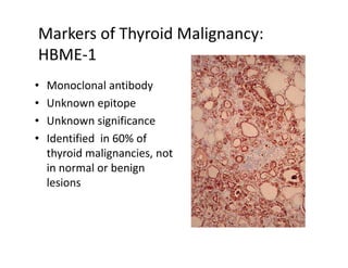 Markers of Thyroid Malignancy:
HBME-1
•   Monoclonal antibody
•   Unknown epitope
•   Unknown significance
•   Identified in 60% of
    thyroid malignancies, not
    in normal or benign
    lesions
 