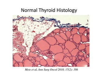 Normal Thyroid Histology




 Mete et al, Ann Surg Oncol 2010, 17(2): 386
 