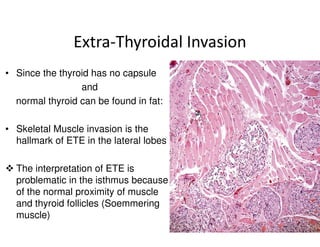 Extra-Thyroidal Invasion
• Since the thyroid has no capsule
                 and
  normal thyroid can be found in fat:

• Skeletal Muscle invasion is the
  hallmark of ETE in the lateral lobes

  The interpretation of ETE is
  problematic in the isthmus because
  of the normal proximity of muscle
  and thyroid follicles (Soemmering
  muscle)
 