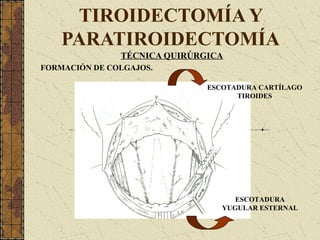 TIROIDECTOMÍA Y
PARATIROIDECTOMÍA
TÉCNICA QUIRÚRGICA
FORMACIÓN DE COLGAJOS.
ESCOTADURA CARTÍLAGO
TIROIDES
ESCOTADURA
YUGULAR ESTERNAL
 