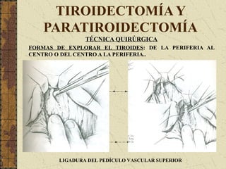 TIROIDECTOMÍA Y
PARATIROIDECTOMÍA
TÉCNICA QUIRÚRGICA
FORMAS DE EXPLORAR EL TIROIDES: DE LA PERIFERIA AL
CENTRO O DEL CENTRO A LA PERIFERIA..
LIGADURA DEL PEDÍCULO VASCULAR SUPERIOR
 