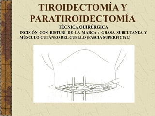 TIROIDECTOMÍA Y
PARATIROIDECTOMÍA
TÉCNICA QUIRÚRGICA
INCISIÓN CON BISTURÍ DE LA MARCA : GRASA SUBCUTANEA Y
MÚSCULO CUTÁNEO DEL CUELLO (FASCIA SUPERFICIAL)
 