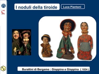 Burattini di Bergamo : Gioppino e Gioppina  (  1824 ) I noduli della tiroide Luca Piantoni  