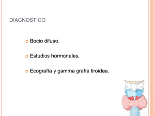 DIAGNOSTICO
 Bocio difuso.
 Estudios hormonales.
 Ecografía y gamma grafía tiroidea.
 
