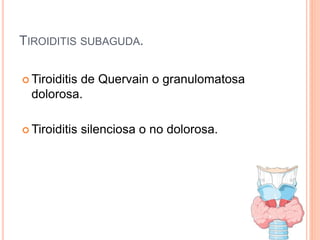TIROIDITIS SUBAGUDA.
 Tiroiditis de Quervain o granulomatosa
dolorosa.
 Tiroiditis silenciosa o no dolorosa.
 