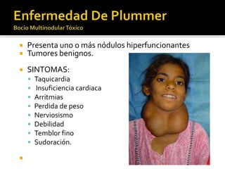  Presenta uno o más nódulos hiperfuncionantes
 Tumores benignos.
 SINTOMAS:
 Taquicardia
 Insuficiencia cardiaca
 Arritmias
 Perdida de peso
 Nerviosismo
 Debilidad
 Temblor fino
 Sudoración.

 