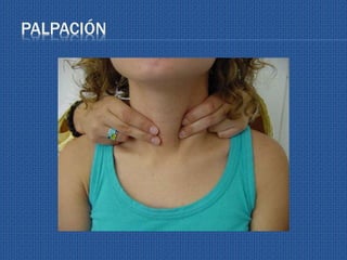 PALPACIÓN
 