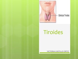 Tiroides
VICTORIA CASTILLO ORTIZ
 