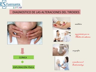 analítica
ecografía
consulta con el
Endocrinólogo
seguimiento por su
Médico de cabecera
EXPLORACIÓN FÍSICA
DIAGNOSTICO DE LAS ALTERACIONES DEL TIROIDES
CLÍNICA