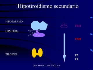 Dra. CARMEN Z. MOLINA V. 2010
Hipotiroidismo secundario
HIPOTALAMO-
HIPOFISIS
TIROIDES
TRH
TSH
T3
T4
 