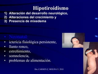 Dra. CARMEN Z. MOLINA V. 2010
Hipotiroidismo
1) Alteración del desarrollo neurológico,
2) Alteraciones del crecimiento y
3) Presencia de mixedema
• Neonatal:
• ictericia fisiológica persistente,
• llanto ronco,
• estreñimiento,
• somnolencia,
• problemas de alimentación.
 