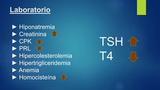 Laboratorio
► Hiponatremia
► Creatinina
► CPK
► PRL
► Hipercolesterolemia
► Hipertrigliceridemia
► Anemia
► Homocisteína
TSH
T4
 