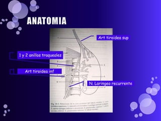 ANATOMIAArt tiroidea sup1 y 2 anillostraquealesArt tiroideainfN. Laringeorecurrente