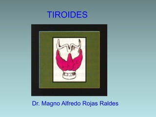 TIROIDES
Dr. Magno Alfredo Rojas Raldes
 