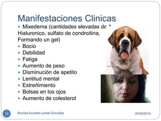 Manifestaciones Clinicas 
 Mixedema (cantidades elevadas de A. 
Hialuronico, sulfato de condroitina, 
Formando un gel) 
 Bocio 
 Debilidad 
 Fatiga 
 Aumento de peso 
 Disminución de apetito 
 Lentitud mental 
 Estreñimiento 
 Bolsas en los ojos 
 Aumento de colesterol 
13 Brenda Escarlet Lomeli González 20/09/2014 
 