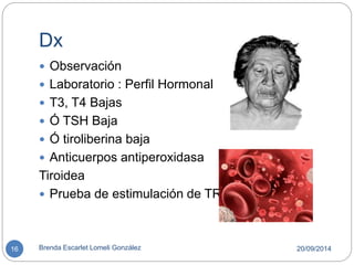 Dx 
 Observación 
 Laboratorio : Perfil Hormonal 
 T3, T4 Bajas 
 Ó TSH Baja 
 Ó tiroliberina baja 
 Anticuerpos antiperoxidasa 
Tiroidea 
 Prueba de estimulación de TRH 
16 Brenda Escarlet Lomeli González 20/09/2014 
 