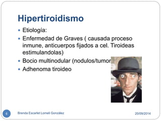Hipertiroidismo 
 Etiología: 
 Enfermedad de Graves ( causada proceso 
inmune, anticuerpos fijados a cel. Tiroideas 
estimulandolas) 
 Bocio multinodular (nodulos/tumores) 
 Adhenoma tiroideo 
6 Brenda Escarlet Lomeli González 20/09/2014 
 