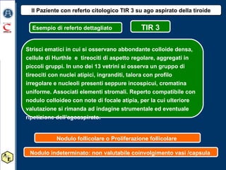 Il Paziente con referto citologico TIR 3 su ago aspirato della tiroide Esempio di referto dettagliato Strisci ematici in cui si osservano abbondante colloide densa, cellule di Hurthle  e  tireociti di aspetto regolare, aggregati in piccoli gruppi. In uno dei 13 vetrini si osserva un gruppo di tireociti con nuclei atipici, ingranditi, talora con profilo irregolare e nucleoli presenti seppure incospicui, cromatina uniforme. Associati elementi stromali. Reperto compatibile con nodulo colloideo con note di focale atipia, per la cui ulteriore valutazione si rimanda ad indagine strumentale ed eventuale ripetizione dell’agoaspirato. TIR 3 Nodulo follicolare o Proliferazione follicolare  Nodulo indeterminato: non valutabile coinvolgimento vasi /capsula  