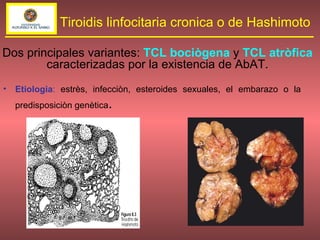 Etiologia :  estrès, infecciòn, esteroides sexuales, el embarazo o la predisposiciòn genètica . Tiroidis linfocitaria cronica o de Hashimoto Dos principales variantes:  TCL bociògena   y  TCL atròfica  caracterizadas por la existencia de AbAT. 