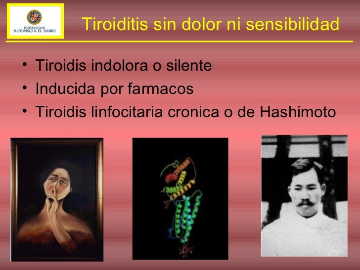 Tiroiditis