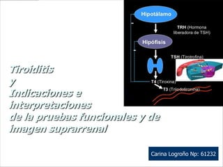 Tiroiditis
y
Indicaciones e
interpretaciones
de la pruebas funcionales y de
imagen suprarrenal

                            Carina Logroño Np: 61232
 