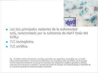 Patogenia.
   Las dos principales variantes de la enfermedad
    está, caracterizads por la existencia de AbAT (más del
    95%):
   TLC bociogénica.
   TLC atrófica.


    Fig. Tiroiditis crónica linfocitaria. Punción aspiración con aguja fina: extendido con un fondo
    inflamatorio linfocitario y formaciones foliculares con transformación oncocítica. En el margen
    inferior izquierdo detalle de un grupo de oncocitos con citoplasma amplio y granular y núcleos
    redondos con frecuentes nucléolos. Tomada del Fondo de Imagen en Endocrinología y Nutrición de
    la Sociedad Española de Endocrinología y Nutrición
 