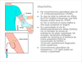 Diagnóstico.

   Por concentraciones plasmáticas altas de
    17- α-hidroxiprogesterona (17OHP).
   En caso de duda se estimula con 250µg
    de ACTH sintética intravenosa, una hora
    después análisis basal de 17OHP:
    En HSC el estímulo al menos triplica la
    cifra basal quedando en 8ng/ml.
   Se a preconizado el uso de
    dehidroepiandrosterona sulfato (DHEAS)
    con el marcador de exceso de
    andrógenos de origen suprarrenal. Sin
    embargo, elevaciones moderadas
    pueden en contrarse en el síndrome de
    ovario poliquístico (SOP) en
    concentración de (DHEAS >
    18,5µmol/l, practicamente diagnostica
    tumos suprarrenal.
   Concentraciones plasmáticas de
    testosterona > 3.5 ng/ml puede ser
    ovarica o suprarrenal
 