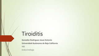 Tiroiditis
González Rodríguez Josué Antonio
Universidad Autónoma de Baja California
486
Endocrinología
 