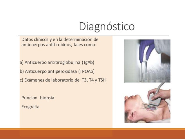Tiroiditis de hashimoto