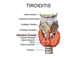 TIROIDITIS 