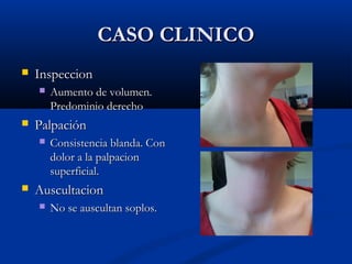 CCAASSOO CCLLIINNIICCOO 
 IInnssppeecccciioonn 
 AAuummeennttoo ddee vvoolluummeenn.. 
PPrreeddoommiinniioo ddeerreecchhoo 
 PPaallppaacciióónn 
 CCoonnssiisstteenncciiaa bbllaannddaa.. CCoonn 
ddoolloorr aa llaa ppaallppaacciioonn 
ssuuppeerrffiicciiaall.. 
 AAuussccuullttaacciioonn 
 NNoo ssee aauussccuullttaann ssooppllooss.. 
 