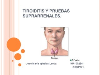 TIROIDITIS Y PRUEBAS
SUPRARRENALES.
José María Iglesias Leyva. NP.100284.
GRUPO 1.
 