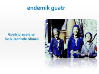 Guatr prevalansı
%10 üzerinde olması
endemik guatr
 