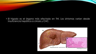 • El hígado es el órgano más afectado en THI. Los síntomas varían desde
insuficiencia hepática a cirrosis y CHC.
 