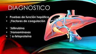 DIAGNOSTICO
 Pruebas de función hepática
 ↓Factores de coagulación
 ↑bilirrubina
 ↑transaminasas
 ↑ α-fetoproteína
 