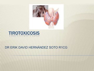 TIROTOXICOSIS

DR ERIK DAVID HERNÁNDEZ SOTO R1CG
 