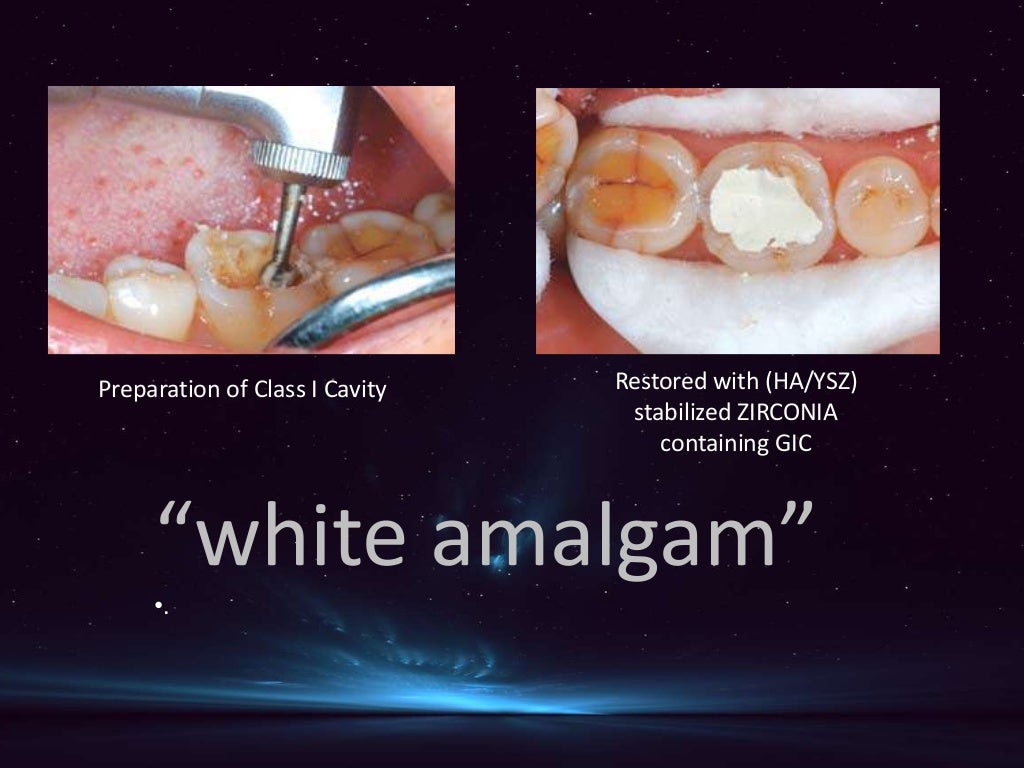Biomimetic materials used in conservative dentistry & endodontics