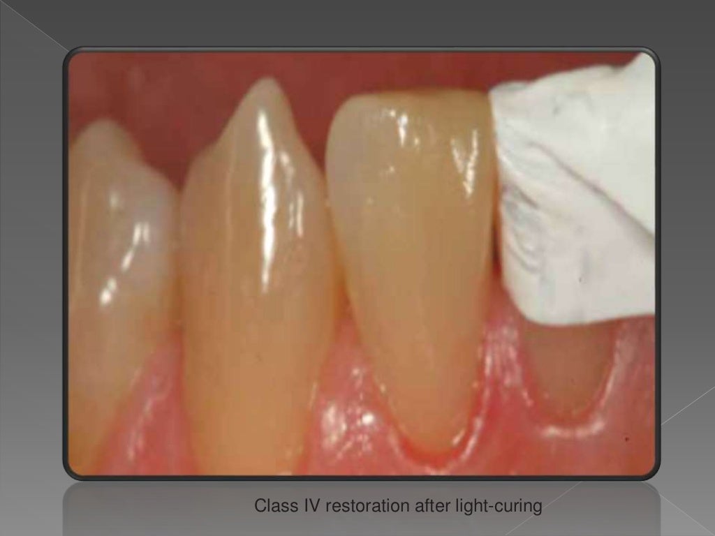 Biomimetic materials used in conservative dentistry & endodontics