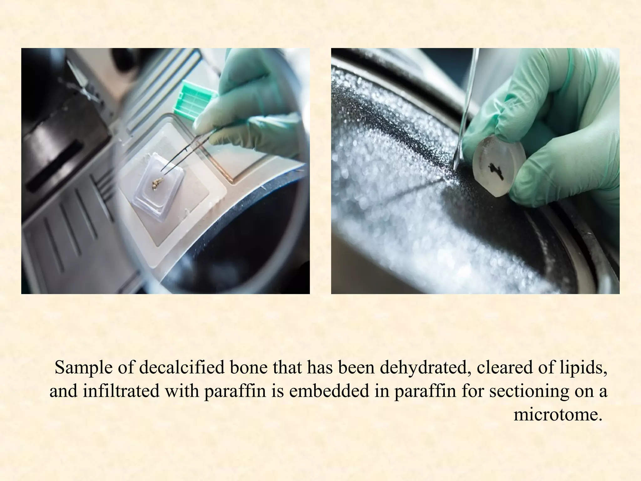 Sample of decalcified bone that has been dehydrated, cleared of lipids,
and infiltrated with paraffin is embedded in paraffin for sectioning on a
microtome.
 